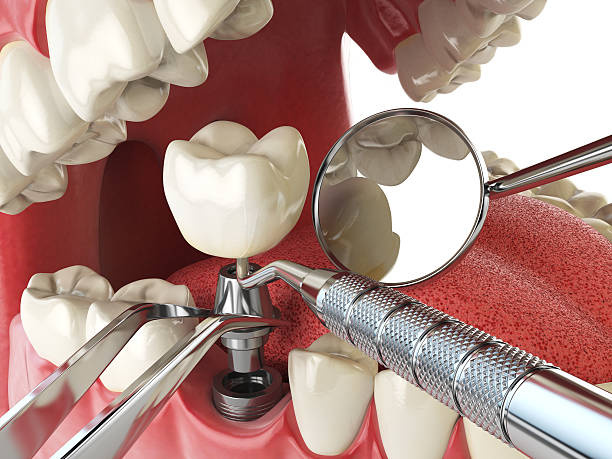 Best Urgent Dental Care for Toothache in Vandenberg Village, CA